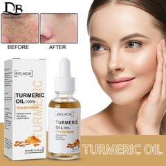 Skin Care Lightening Acne Dark