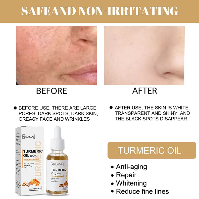 Skin Care Lightening Acne Dark