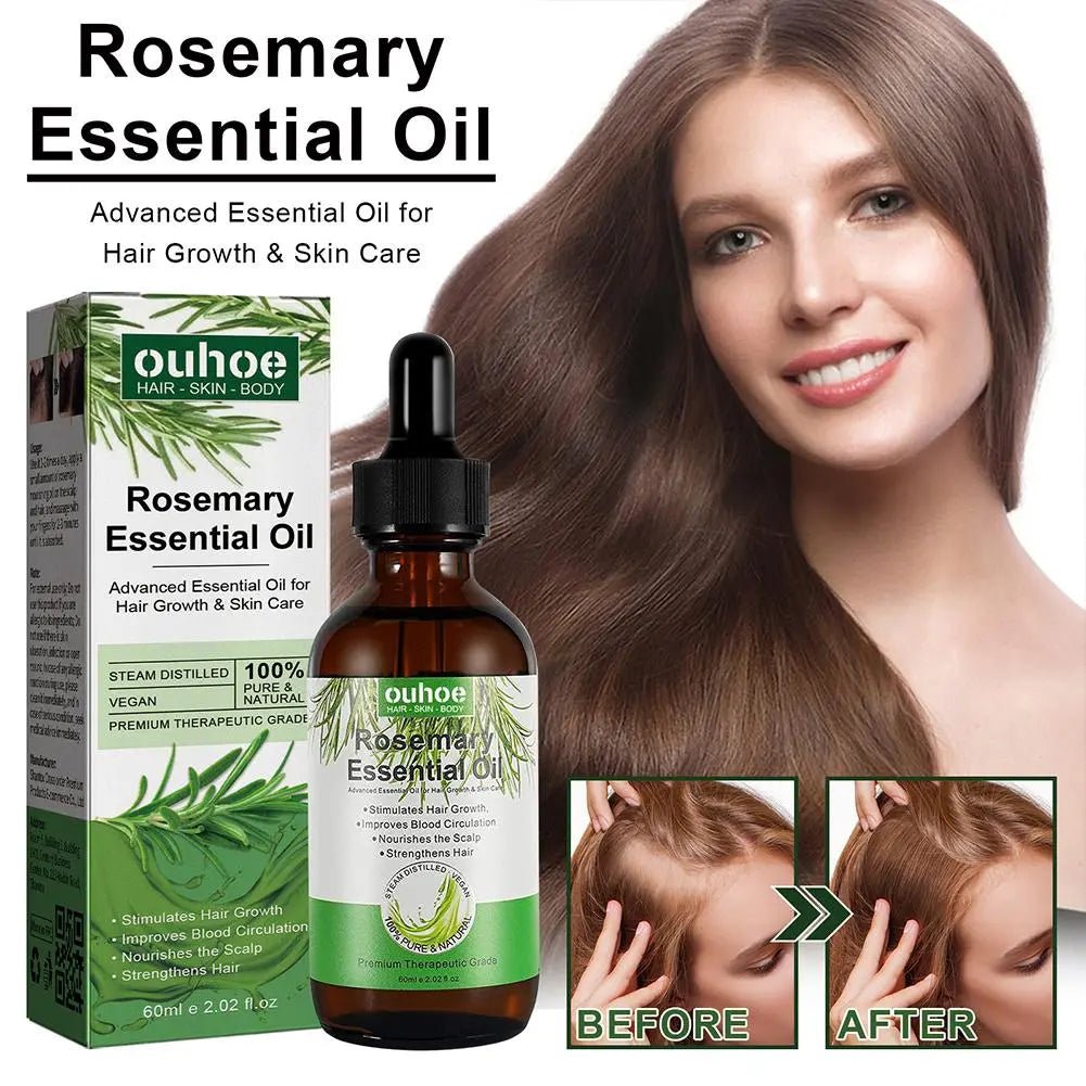 Fast Rosemary Black Seed Essential Oils Oil Spray For Hair Care And Growth To Prevent Hair Loss Strengthens Hai K8M2