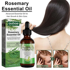 Fast Rosemary Black Seed Essential Oils Oil Spray For Hair Care And Growth To Prevent Hair Loss Strengthens Hai K8M2