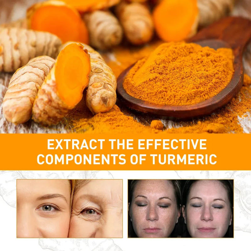 Turmeric Remove Dark Spots Essential Oil Anti wrinkle Serum 100% Pure Therapeutic Grade Face Whitening Moisturizing Skin Care