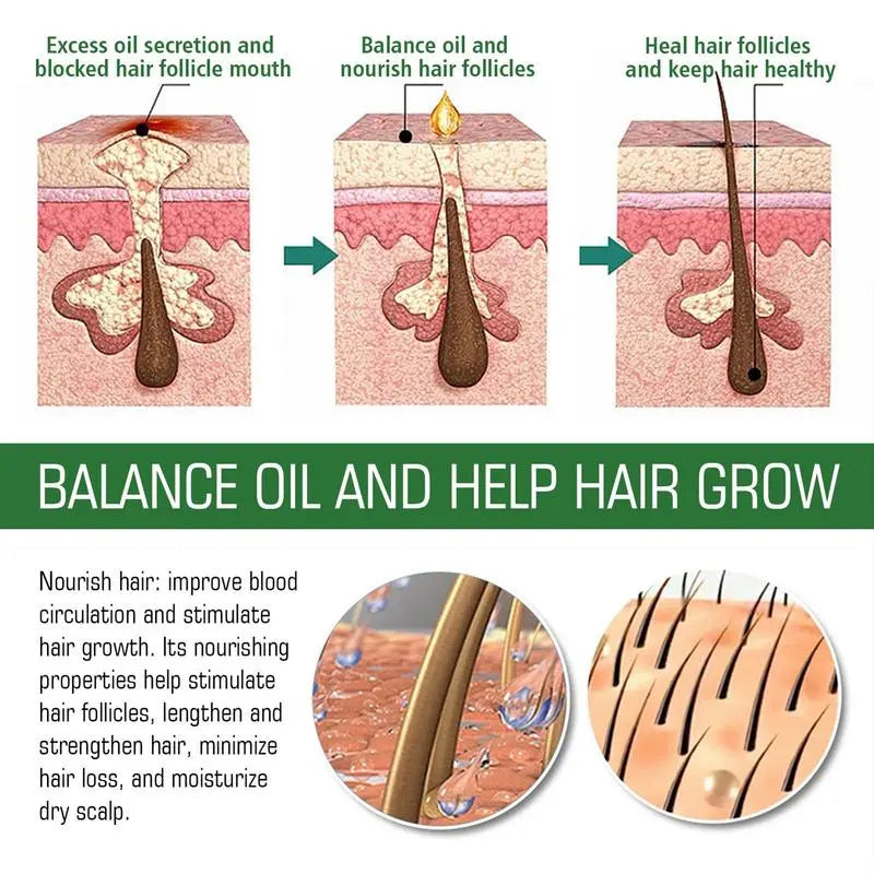 Hair Growth Oil Hair Growth Oil Scalp & Hair Strengthening Oil Aromatherapy Organic Rosemary Oil With Glass Dropper Improve