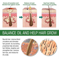 Hair Growth Oil Hair Growth Oil Scalp & Hair Strengthening Oil Aromatherapy Organic Rosemary Oil With Glass Dropper Improve