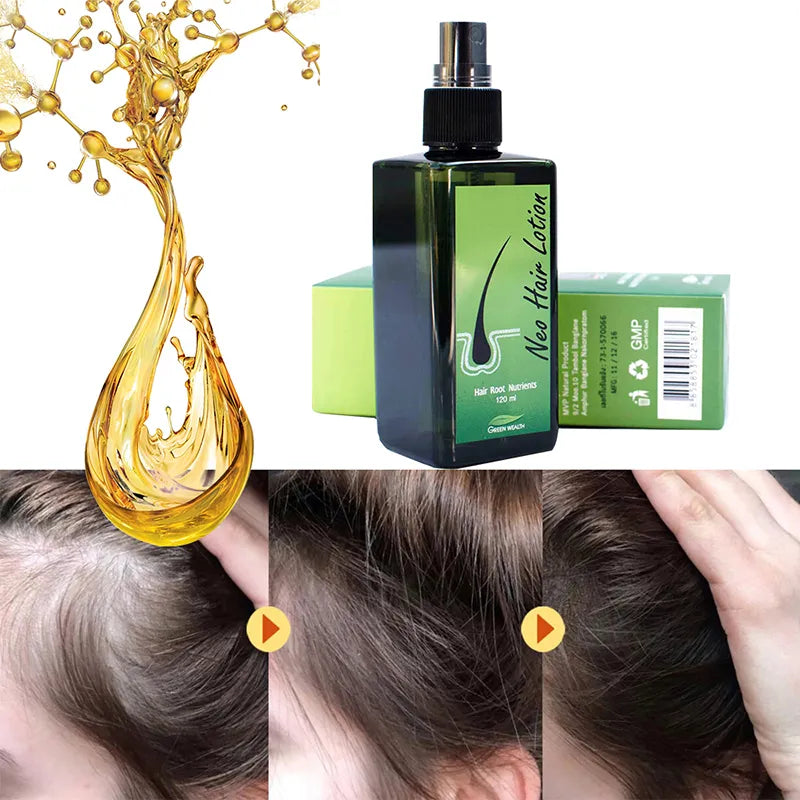 Hair Lotion Hair Care Oil Hair Grow Serum Essential Hair Loss Treatment