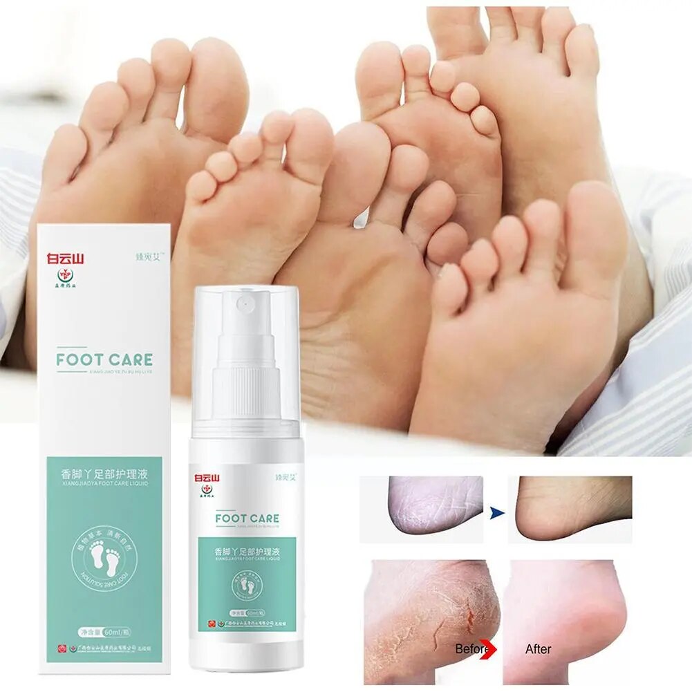 Herbal Fragrance Foot Deodorizing Spray Herbaceous Plant Shoe Care Care Health Fresheners Personal Anti Foot Cracking Extra E7B3