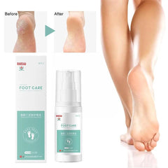 Herbal Fragrance Foot Deodorizing Spray Herbaceous Plant Shoe Care Care Health Fresheners Personal Anti Foot Cracking Extra E7B3