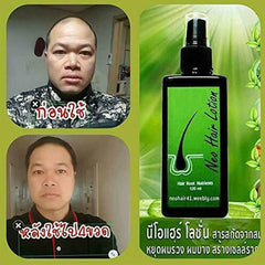 Hair Lotion Hair Care Oil Hair Grow Serum Essential Hair Loss Treatment